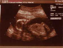 Click to popup fullsize image